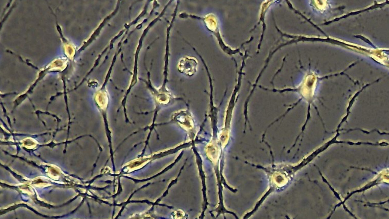 Image displays ability of EVOS XL Core to capture high quality phase contrast images captured using EVOS XL Core with 20x magnification